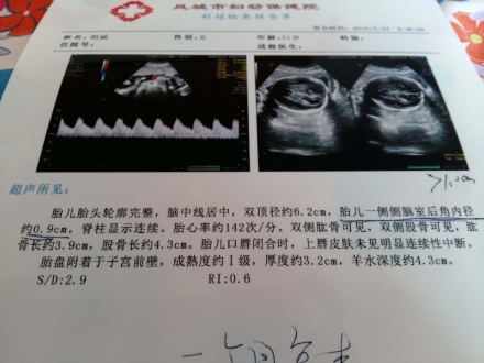 六个月胎儿双顶径标准