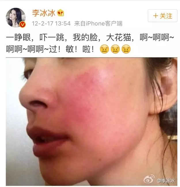 脸过敏痘痘
