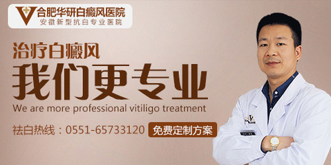 白癜风该怎么治疗好