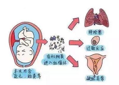 高血压能否怀孕生孩子