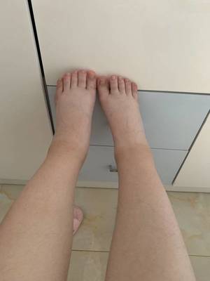 脚脖肿是怎么回事