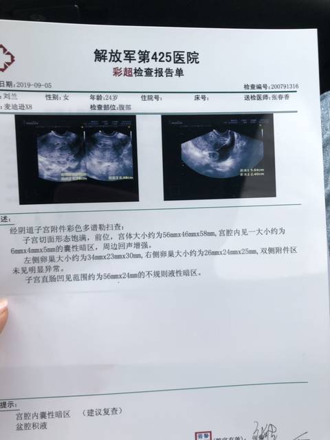 什么检查能查出怀孕
