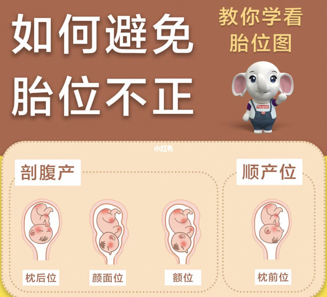 胎儿胎位什么时候固定