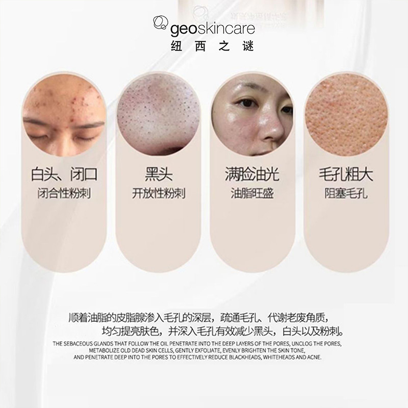 痘痘肌肤可以用精华液吗