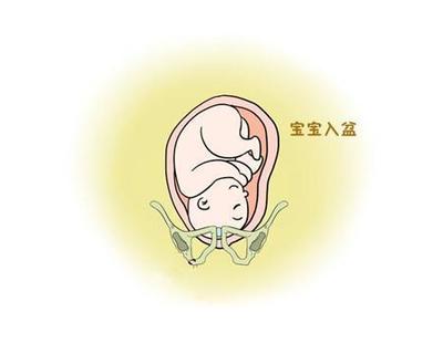 胎儿入盆的症状