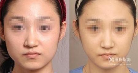 瑜伽可以瘦脸吗