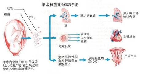 孕妇凝血功能