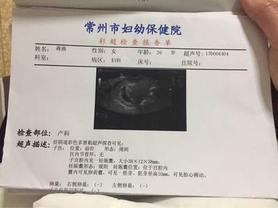 怀孕2个月最准看男女