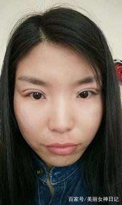 双眼皮如何抽脂