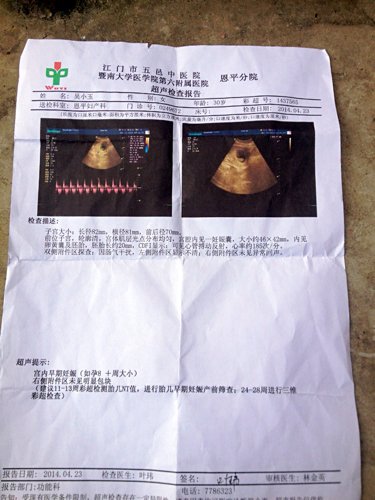 孕妇胎儿心跳多少正常