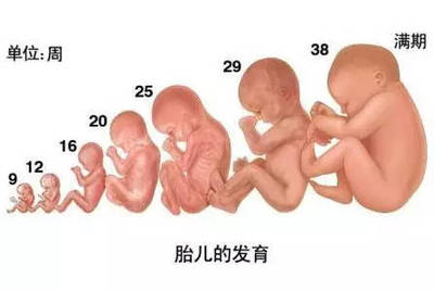 胎儿发育畸形