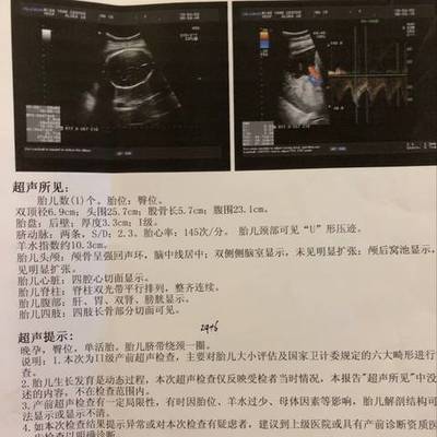 胎儿照片大全集32周