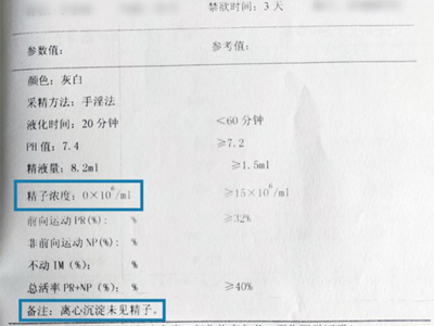 精子液化时间长怎么治疗