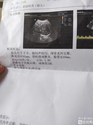 35周胎儿图片