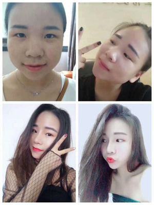 双眼皮广告宣传语