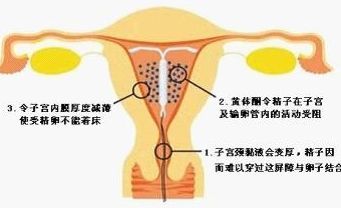 上环久了会影响怀孕吗