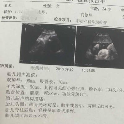 36周宝宝多少斤才正常