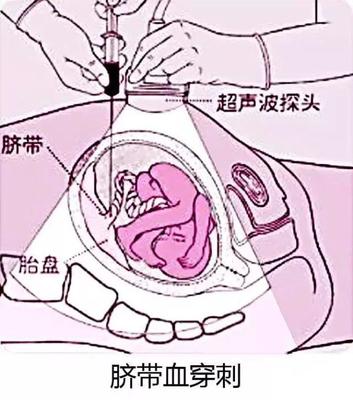 怀孕两个月孩子多大