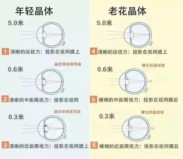 花眼是怎么回事