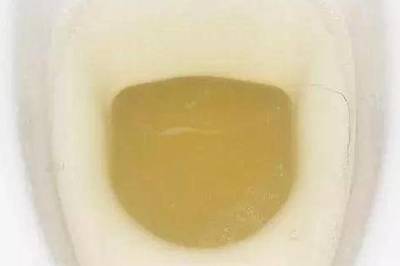 小便发浑是怎么回事