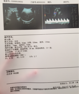 胎儿与胎盘的位置图片