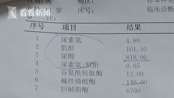 成年人尿酸正常是多少