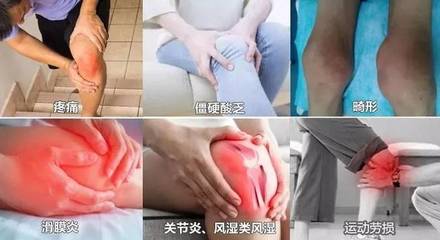 膝盖发热是怎么回事