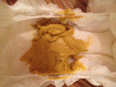 宝宝拉的粑粑黏糊糊的