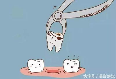 乳牙掉时出血怎么处理