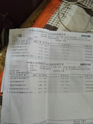 抗甲状腺球蛋白抗体高是怎么回事