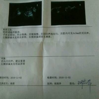 流产多久能怀孕