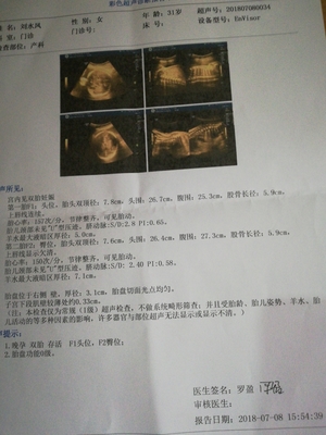 三维四维彩超几个月做