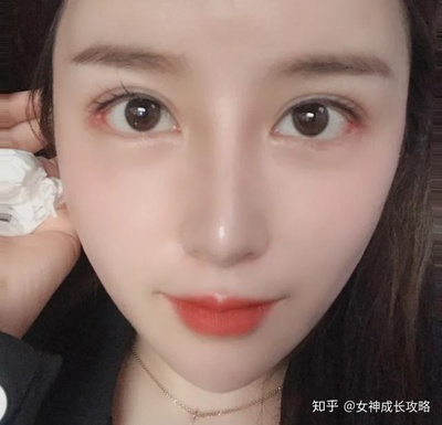 三点双眼皮多久能化妆
