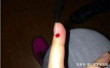 女人梦见自己流血