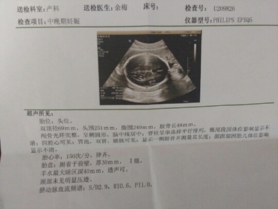 怀孕7个月胎儿有多大
