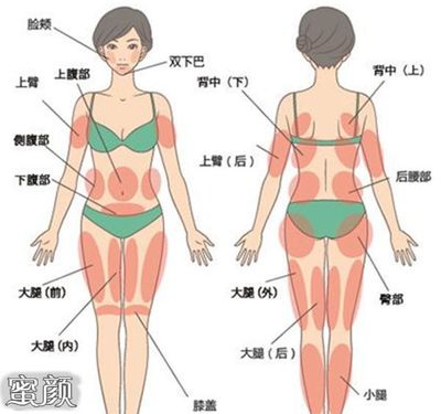环形抽脂