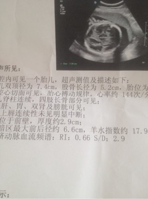 怀孕45天怎么算