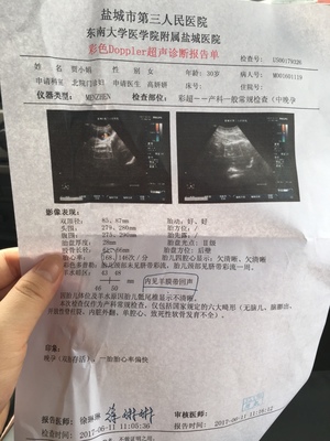 双胎33周宝宝多少克