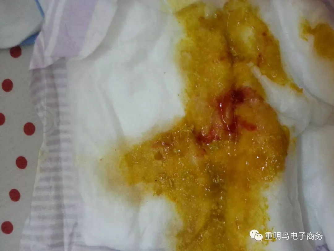 宝宝血便图片