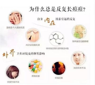 脸上总是反复长粉刺