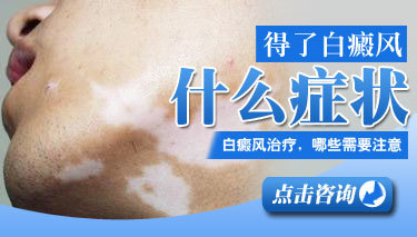 白癜风该怎么治疗好