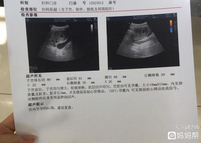 检查是否怀孕挂什么科