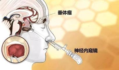 做磁共振和内分泌抽血检查是多少