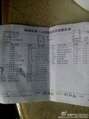 两个月婴儿贫血