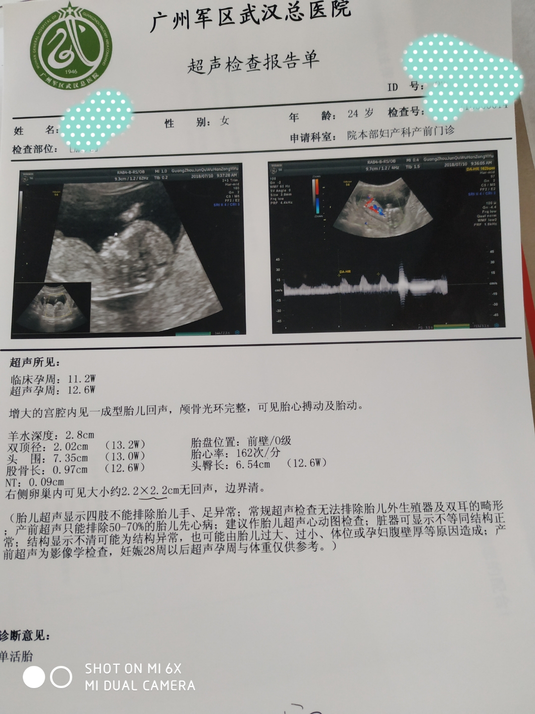 怀孕13周体重增加多少正常