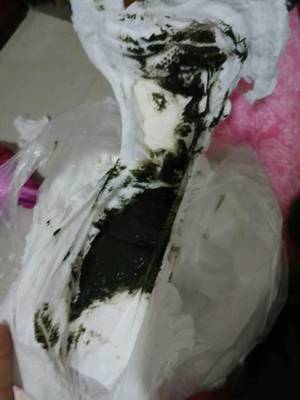 拉黑色粑粑是怎么回事