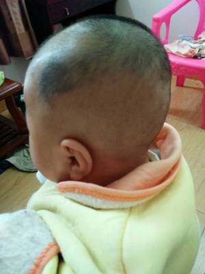 胎宝宝什么时候长头发