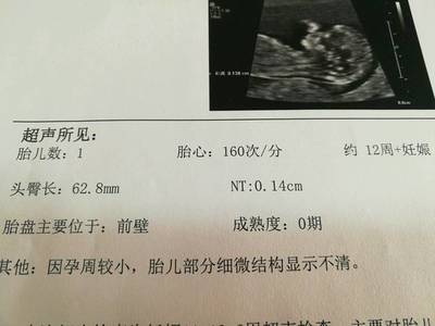 12周胎儿nt值正常范围