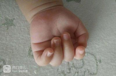三个月的宝宝老吃手是怎么回事