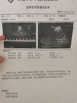 40周孕期多少次检查